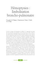 Hémoptysies : Embolisation broncho-pulmonaire - Club Thorax