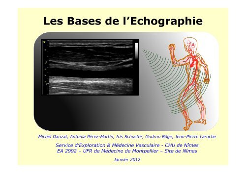 Les Bases de l'Echographie - Ultrasonographie Vasculaire