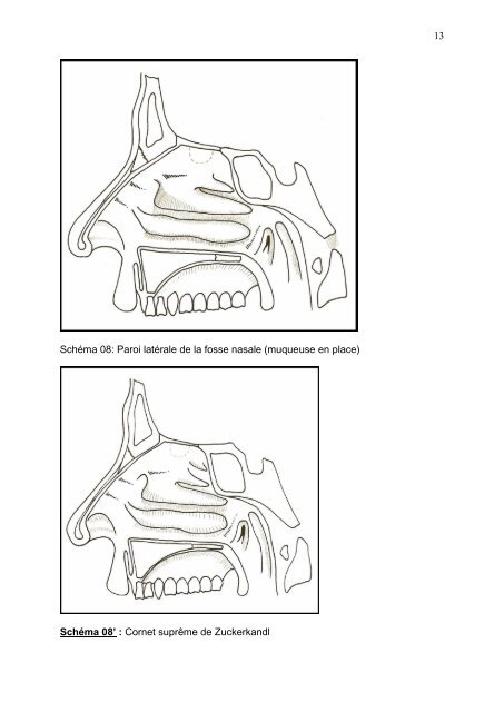 ANATOMIE des FOSSES NASALES et CAVITES SINUSIENNES ...