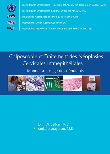 Colposcopie et Traitement des Néoplasies Cervicales Intraépithéliales