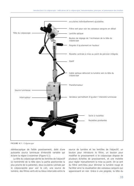 Colposcopie et Traitement des Néoplasies Cervicales Intraépithéliales