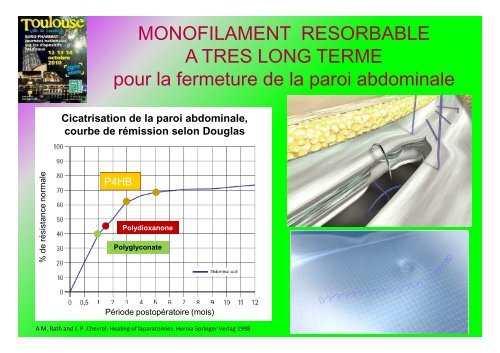 Critères des choix des ligatures et des sutures ... - Euro-Pharmat