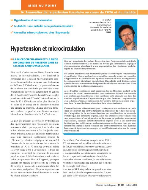 Anomalie de la perfusion tissulaire - Réalités Cardiologiques