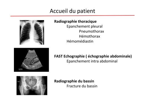 prise en charge du polytraumatisé