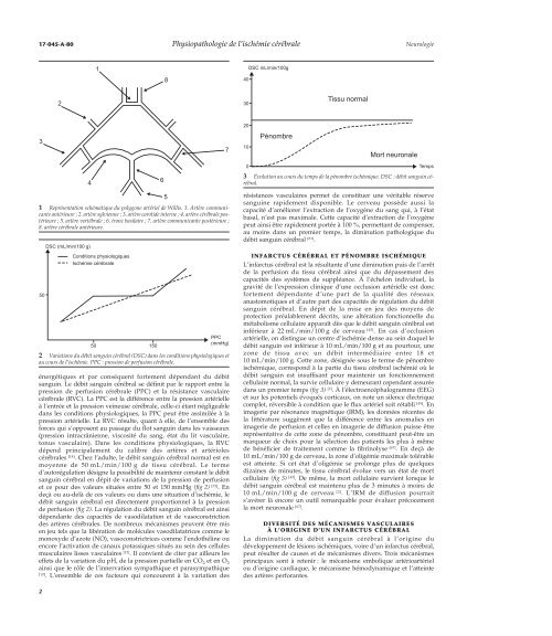 Physiopathologie de l'ischémie cérébrale - Psychologie - M. Fouchey