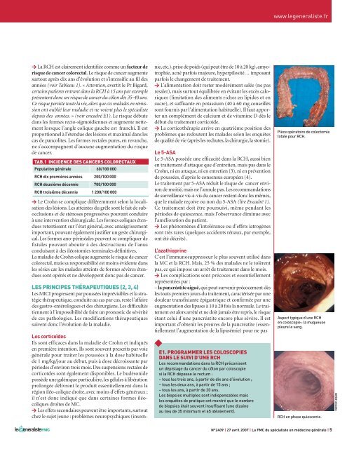 POSER LE DIAGNOSTIC D'UNE MICI - Le Généraliste