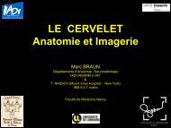 LE CERVELET Anatomie et Imagerie