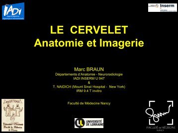 LE CERVELET Anatomie et Imagerie