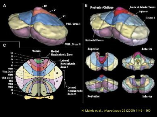 LE CERVELET Anatomie et Imagerie