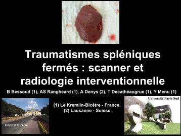 Traumatismes spléniques fermés : scanner et ... - reannecy.org