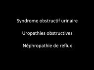Syndrome obstructif urinaire Uropathies obstructives ... - UBIR