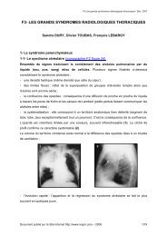 f3- les grands syndromes radiologiques thoraciques - Soutien ...