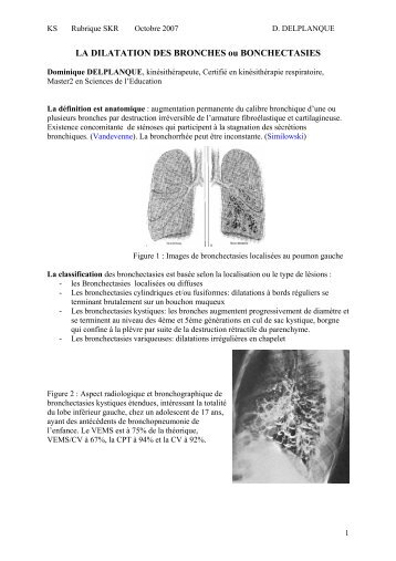 LA DILATATION DES BRONCHES ou BONCHECTASIES