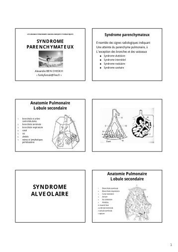 SYNDROME ALVEOLAIRE - Free