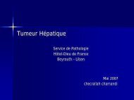 Tumeur Hépatique - epathologies