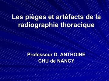 Les pièges et artéfacts de la radiographie thoracique - ammppu