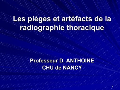 Les pièges et artéfacts de la radiographie thoracique - ammppu