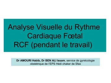 Analyse Visuelle du Rythme Cardiaque Fœtal RCF (pendant le travail)