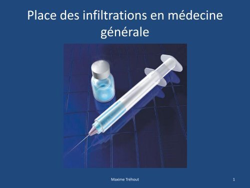 Place des infiltrations en médecine générale