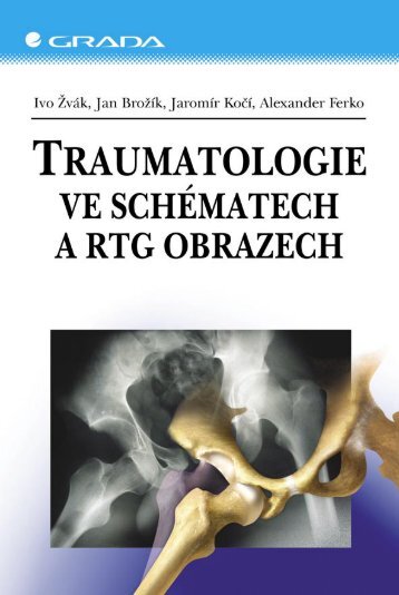 Traumatologie ve schématech a RTG obrazech - eReading