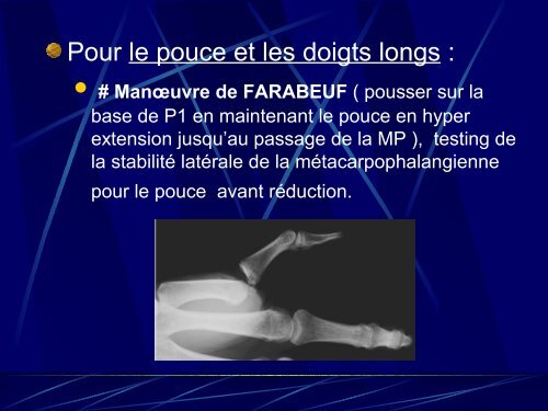 Réduction des luxations de MS - Urgences-Bretagne