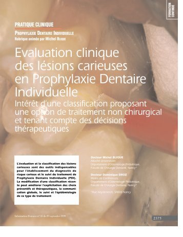 Evaluation clinique des lésions carieuses en Prophylaxie Dentaire ...