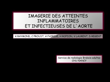 aortites inflammatoires et infectieuse - RADIOLOGIE BRABOIS