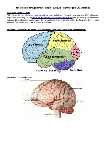 IRM et lecture d'images fonctionnelles de quelques patients (logiciel ...