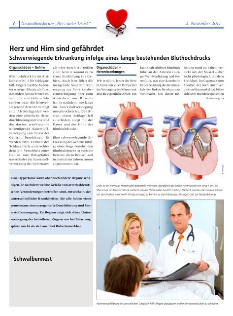 Bluthochdruck und Folgeerkrankungen - SRH Zentralklinikum Suhl