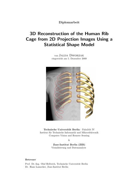3D Reconstruction of the Human Rib Cage from 2D Projection ... - ZIB