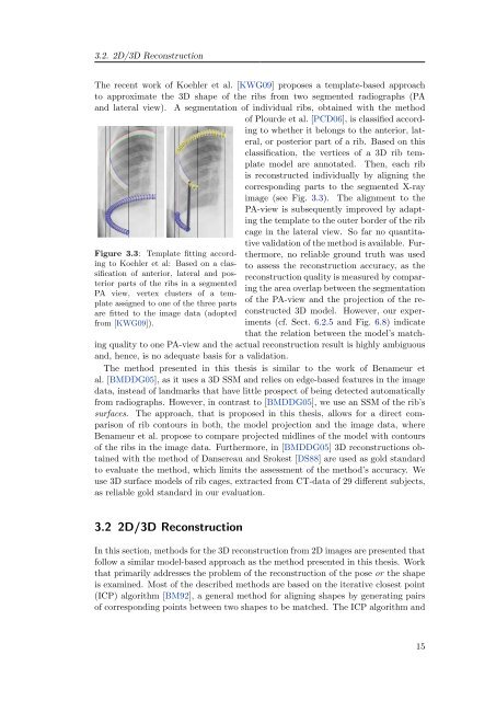 3D Reconstruction of the Human Rib Cage from 2D Projection ... - ZIB