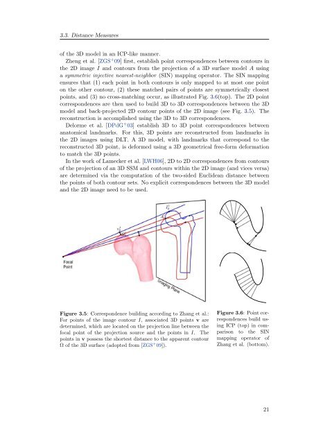 3D Reconstruction of the Human Rib Cage from 2D Projection ... - ZIB