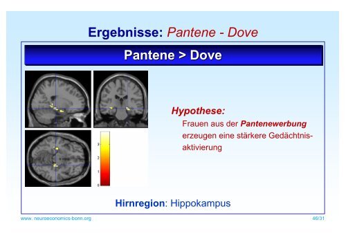 Einblicke ins Kundengehirn mit Verfahren der ... - Neuromarketing