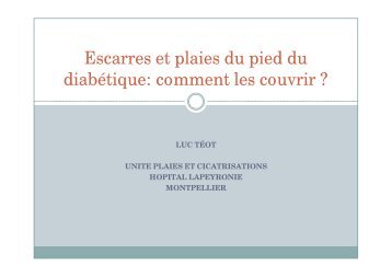 Escarres et plaies du pied du diabétique: comment les couvrir ?