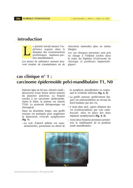 PDF (1.519 MB) - Actualités Odonto-Stomatologiques