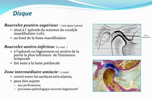 Le ligament stylo mandibulaire - Atlas