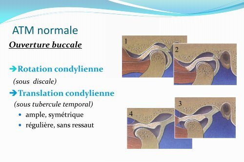 Le ligament stylo mandibulaire - Atlas