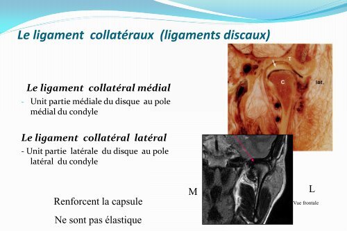 Le ligament stylo mandibulaire - Atlas