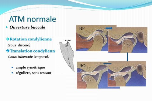 Le ligament stylo mandibulaire - Atlas