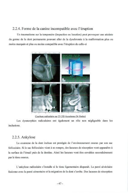 avertissement - Bibliothèques de l'Université de Lorraine