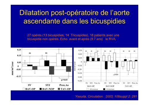 Indications opératoires dans les anévrismes de l'aorte ascendante