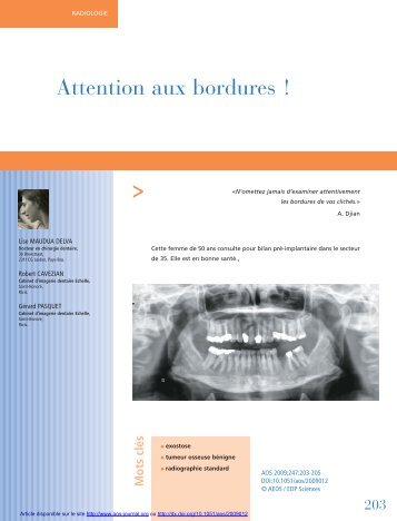 PDF (2.487 MB) - Actualités Odonto-Stomatologiques