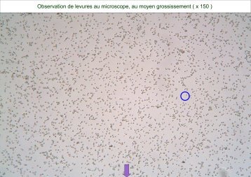 Observation de levures au microscope, au moyen grossissement ( x ...