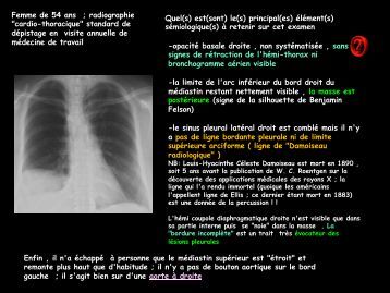 mésothéliome métastase cancer poumon cracher du sang