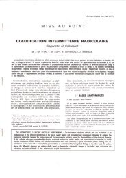 Claudication intermittente radiculaire