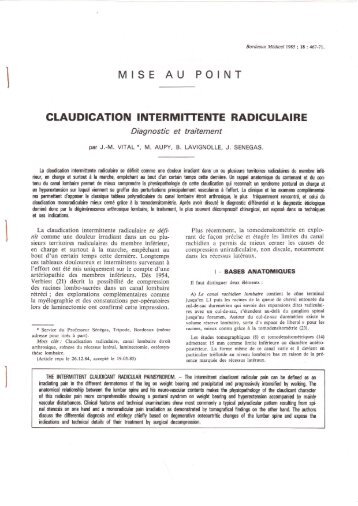 Claudication intermittente radiculaire