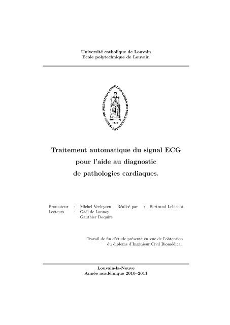 Traitement automatique du signal ECG pour l'aide au diagnostic de ...