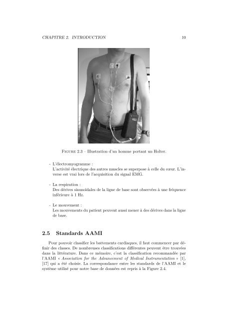 Traitement automatique du signal ECG pour l'aide au diagnostic de ...