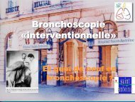 Bronchoscopie « interventionnelle » - DES, AFS et AFSA de ...