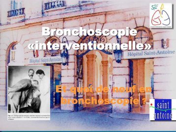 Bronchoscopie « interventionnelle » - DES, AFS et AFSA de ...